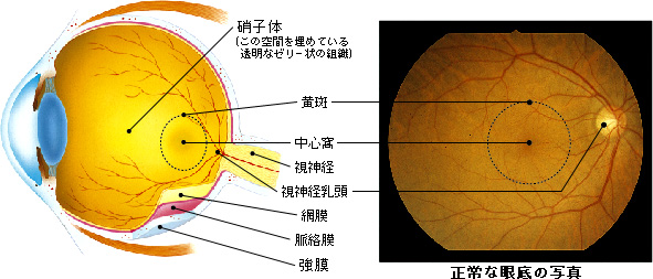 正常な眼底の写真