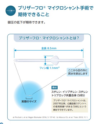 正常な視神経乳頭と緑内障による視神経障害の比較